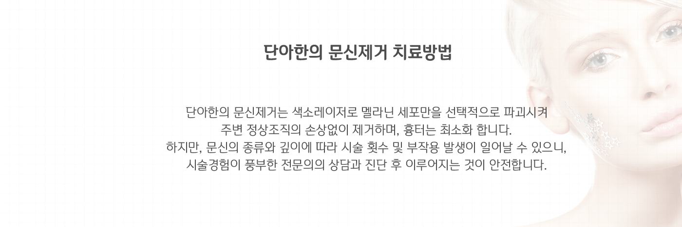 문신제거